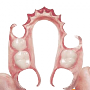 Flexible-Dentures-City-Dental-Birmingham citydental-flexible-denture-birmingham-dentist